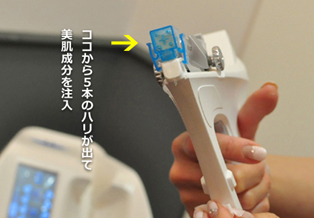 人体干细胞培养提取液（Bastole）