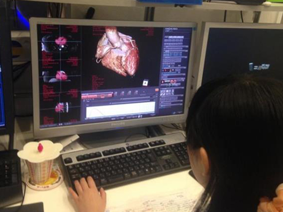 心脏精密检查