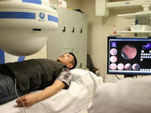 上部消化道内视镜检查